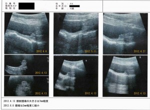 柴犬の膀胱移行上皮癌のエコー（超音波検査）の画像（その２）